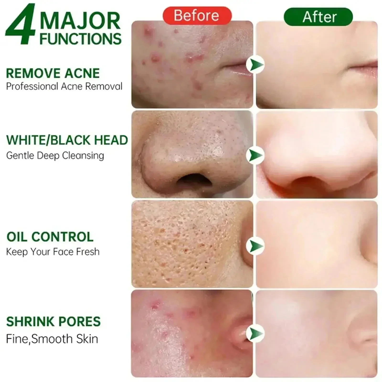Salicylic Acid Pore Clearing C - Salicylic Acid Blackhead Remover recension och pris