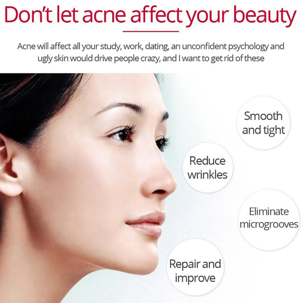 Retinol Lifting Firming Cream  - Retinol Anti Wrinkle Cream recension och pris