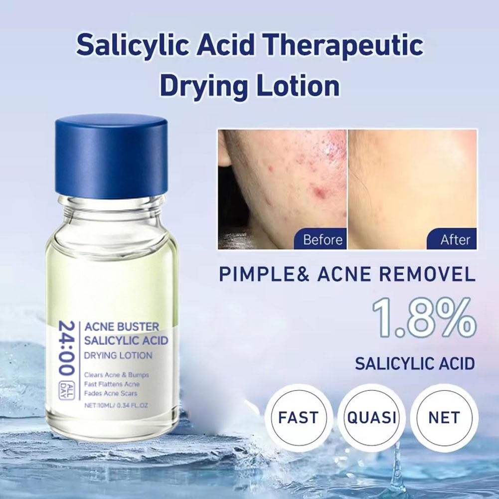 Salicylic Acid Acne Buster Rem - Salicylic Acid Blackhead Remover recension och pris